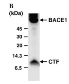 Analysis of BACE1 shedding and extracellular release of BACE1 holoproteins.jpg